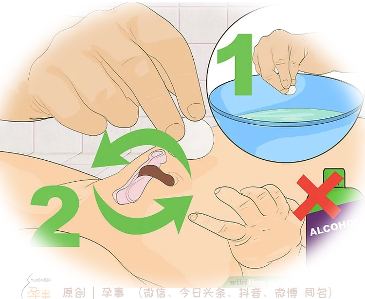 脐带发炎如何预防感染,新生儿脐带感染怎么处理