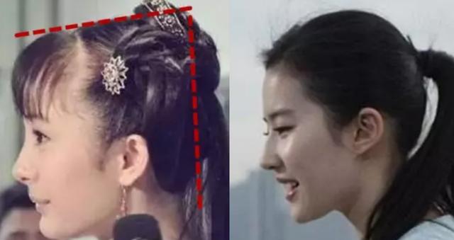 拯救秃头少女的新思路纹发,拯救脱发少女的办法