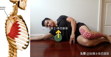 肩胛骨突出矫正的方法,体态矫正脊柱前凸