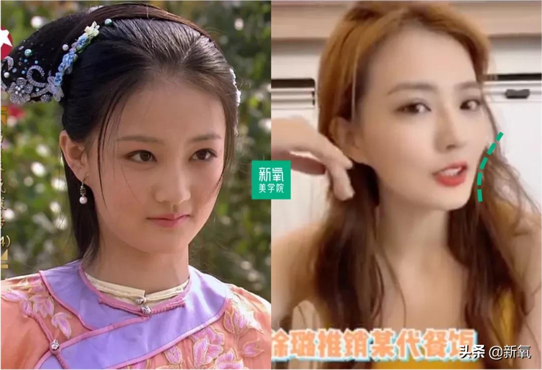 如何用点线面构建空间层次感,面型改善