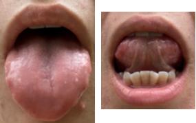 月经崩漏止血中药方,更年期月经崩漏止血的最快方法