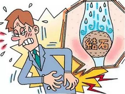 分享两例结石（肾结石、输尿管结石）患者的治疗。