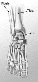 所有骨折都叫什么名字,骨折的名称有哪些