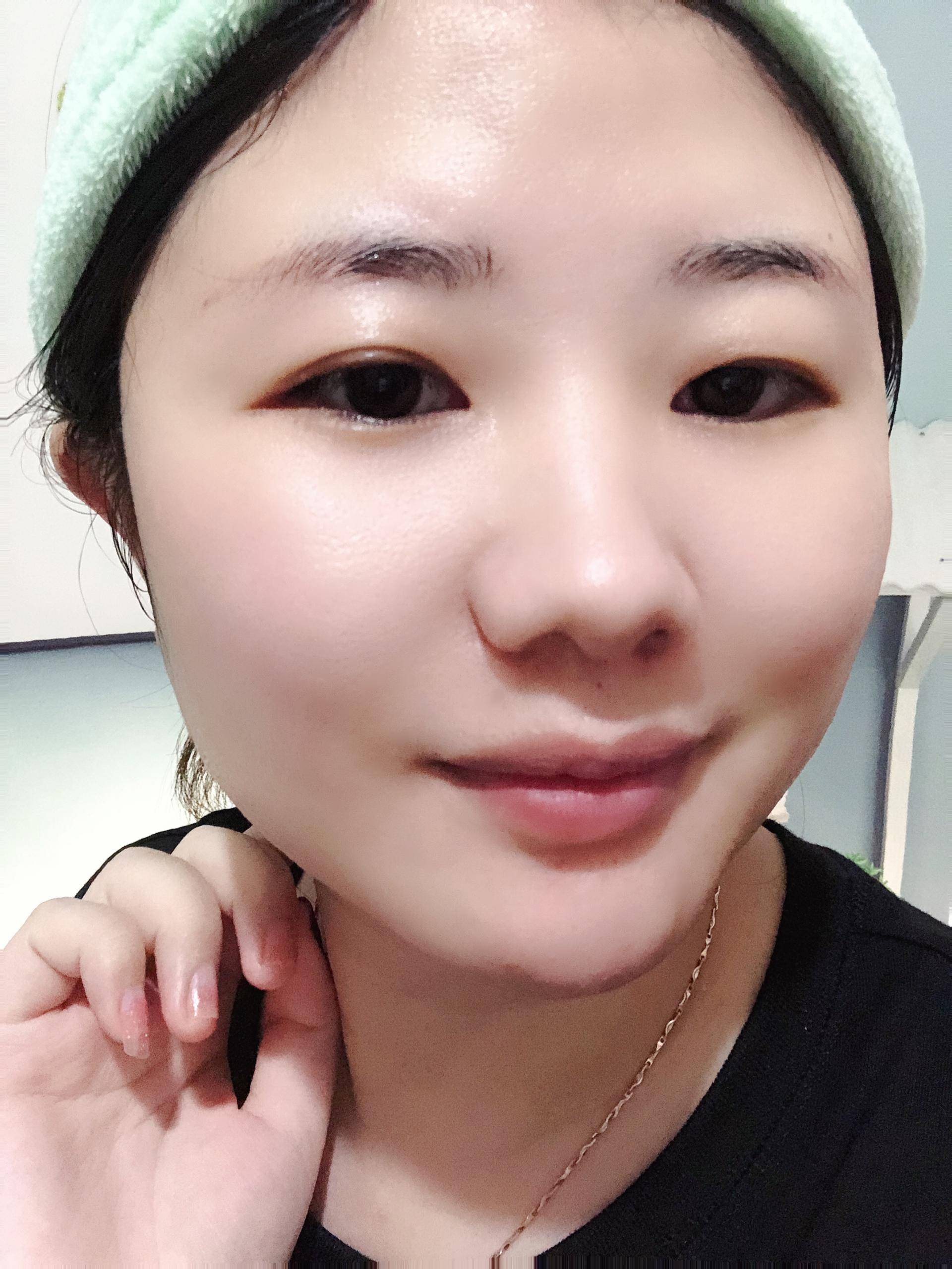 肌肤优化医用冷敷贴,脸部医用冷敷贴怎么用效果好