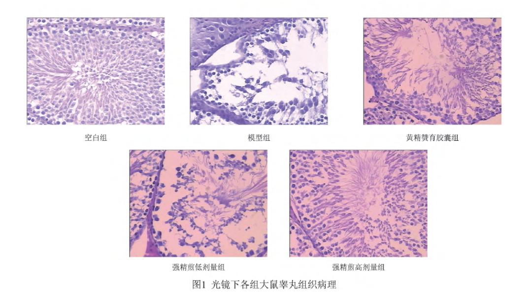 哪些中药方子对男性生育有帮助,补肾壮阳中药会提高睾酮吗