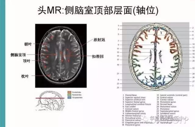 mra头颅解剖学详细讲解视频,常见的头颅mri图像