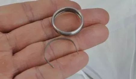 戒指戴不上怎么办小窍门,戒指要怎样戴才合适