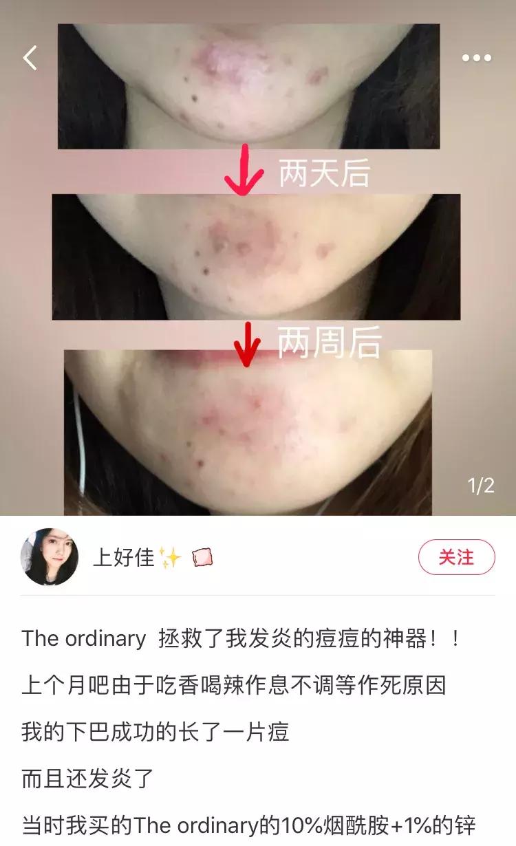 百元内护肤品推荐,送人用百元以内的护肤品