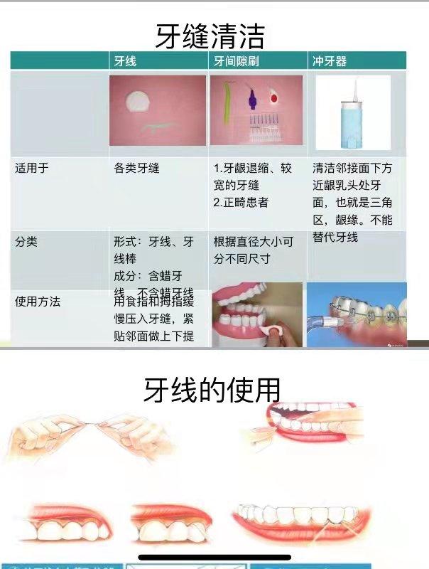 “爱牙日”儿牙医教刷牙哈尔滨医科大学附属哈尔滨儿童医院口腔科医生强调“3-5刷牙法则”保持牙齿最佳状态