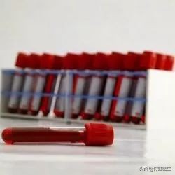 孕13周患新冠肺炎怎么办,孕妈妈得了新冠肺炎怎么办