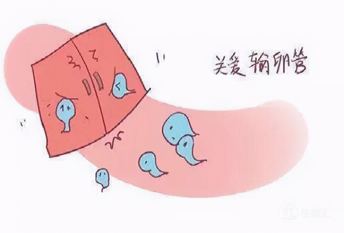 输卵管粘连怎么备孕,楚严