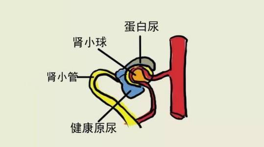 体检发现尿潜血怎么办？别担心，三步帮你解决问题！