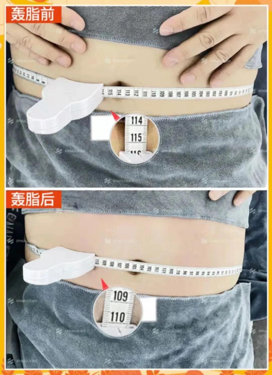 丢掉60斤肉，换回正常水平的内脂，值