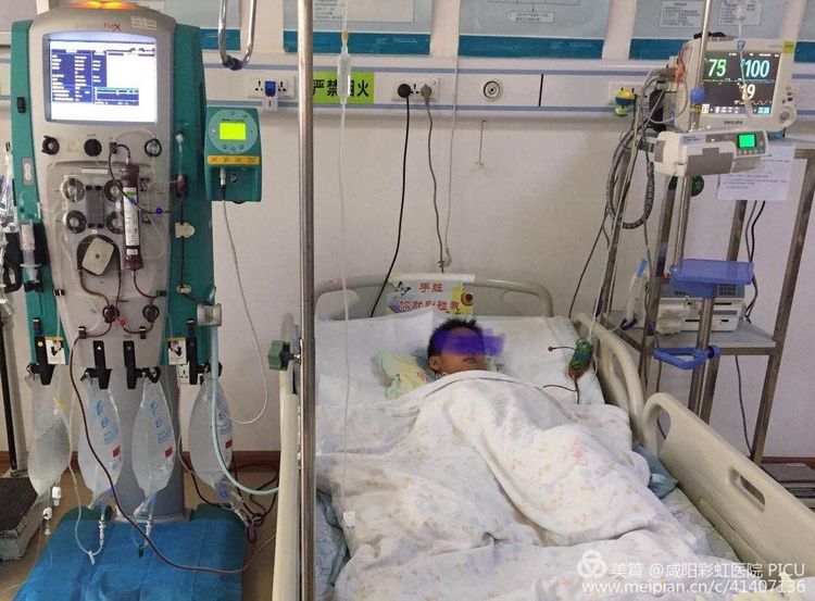 咸阳彩虹医院利用血液净化技术拯救出血热患儿