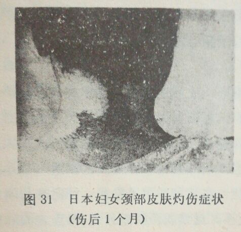 连载：核袭击的防护11第三章第六节,6貌若尘土的放射性沾染