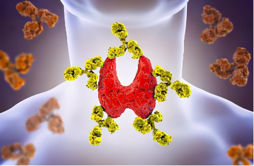 甲状腺结节悄悄偷走健康,岁月神偷被偷走的是什么