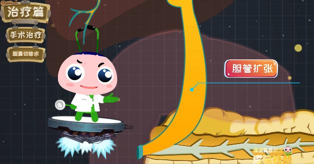 胆囊炎胆结石诊断治疗指南,胆囊结石胆囊炎发作胆绞痛怎么办