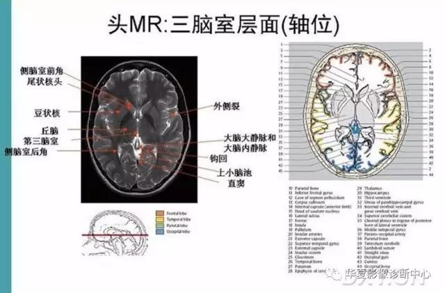 mra头颅解剖学详细讲解视频,常见的头颅mri图像
