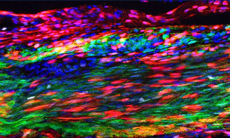 肌腱干细胞可以彻底改变损伤的恢复