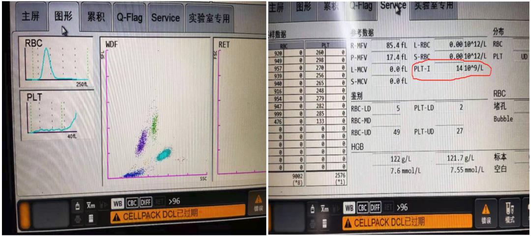 是谁揭开了血小板减少的面纱？