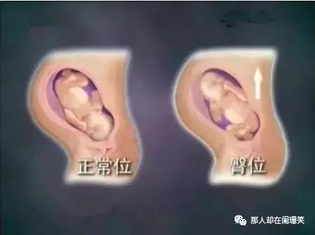 胎儿头位和右位的区别,胎儿头位和头位低的区别