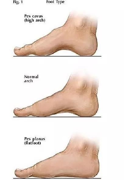 运动鞋不跟脚的鞋带系法,鞋舌不容易跑偏的鞋带系法