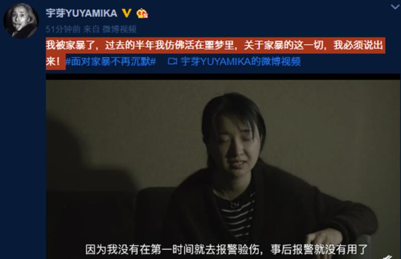 papi酱签约艺人遭家暴，被前任扇耳光烫烟头，男方这表现毫无悔意