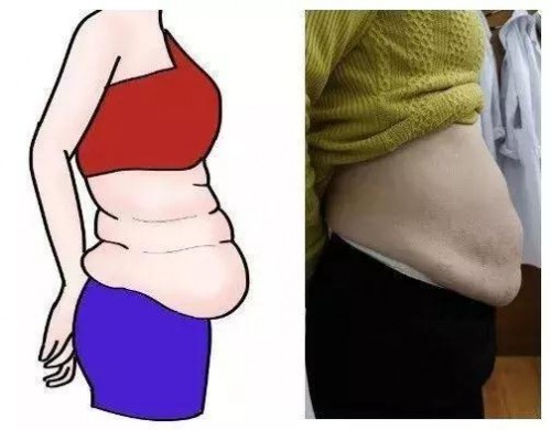 有必要去医院做产后修复吗？看完这些再做决定