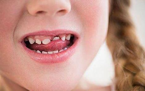 小朋友换牙歪歪扭扭,小孩换牙都长得歪歪扭扭怎么办