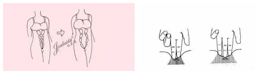 产后腰椎间盘突出正确锻炼方法,产后没有恢复好腰疼