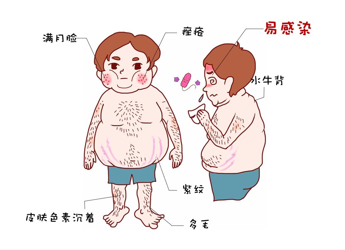 iga肾病免疫球蛋白一定会偏高吗,iga肾病什么时候可以停免疫制剂