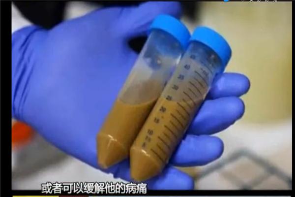 19岁年轻男子痛风2年靠粪便治好？没想到「它」竟有这么多的好处