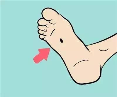 黑痣要去掉吗？专家和你聊聊关于“黑痣”的那些事儿