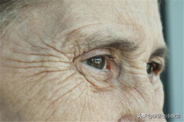 身上有老年味怎么治疗,身上有老年味怎样去除