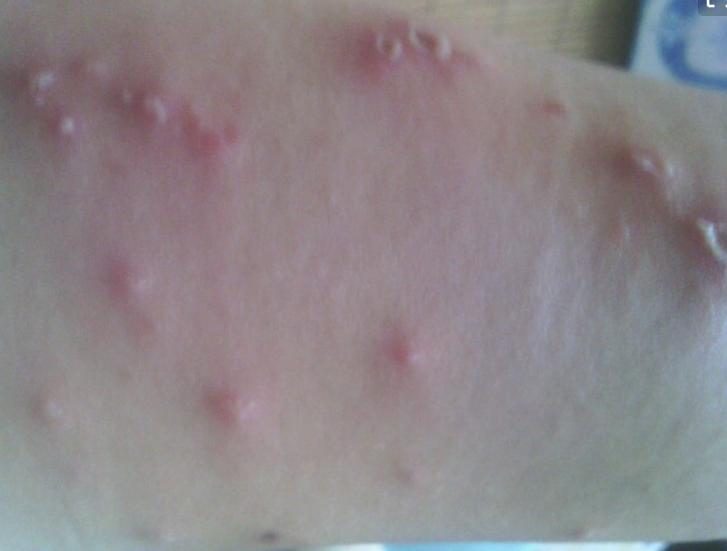 哪些小昆虫对身体有害,生活中常见昆虫存在的危险的视频