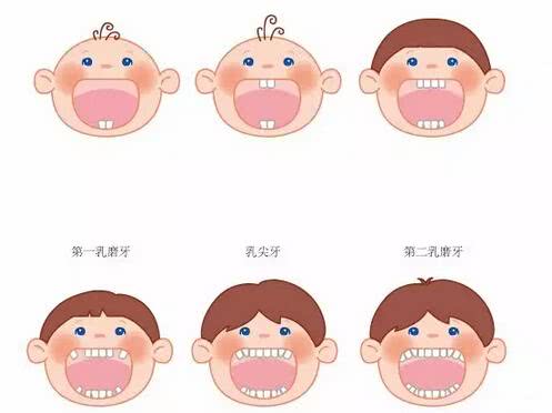 乳牙滞留怎么缓解,乳牙滞留了解一下