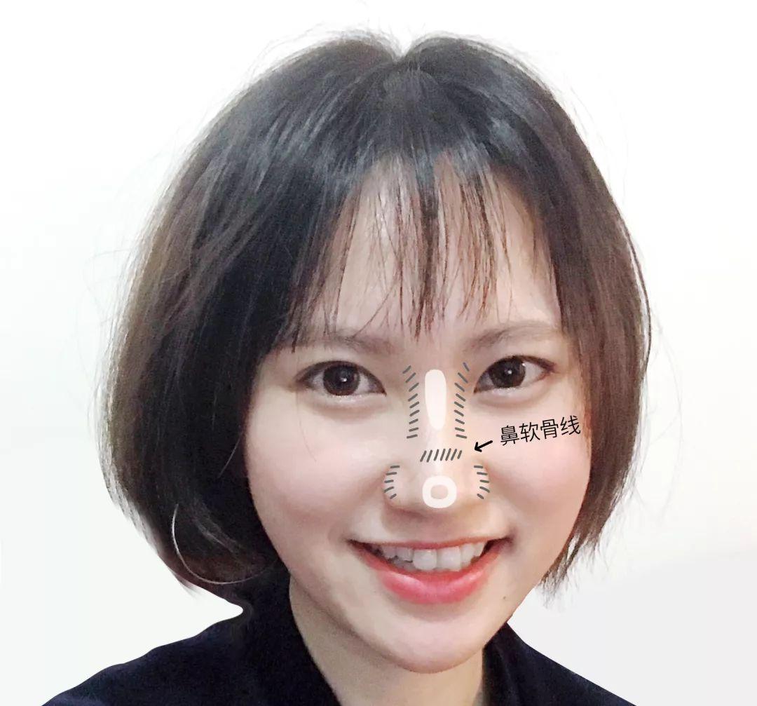 不用动刀鼻子变挺方法,不用修容怎么修鼻子小窍门