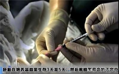 试管婴儿到底有多痛？7张图为你“*放播**”整个过程。