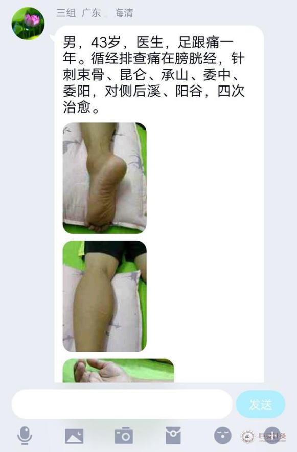 足跟痛是肾阳不足还是肾阴不足,足跟痛是缺阴水还是阳水