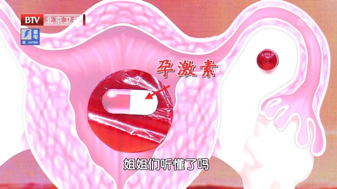 白带异常妇科疾病案例,白带异常就是妇科病前兆