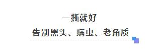 解决黑头的2种药,解决黑头的最好方法