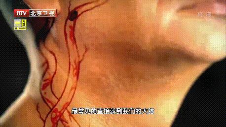 脑血管极细是不是特别危险,脑血管狭窄致命吗