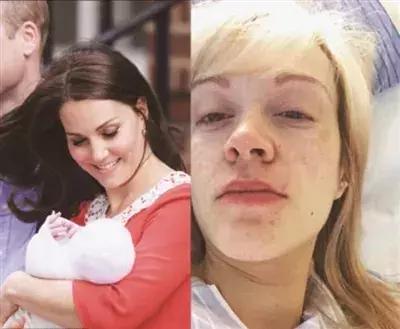 产后做产康会瘦吗,产康妈咪