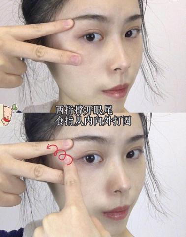 熊猫眼黑眼圈怎么去除,熊猫眼去黑眼圈需要几次有效果