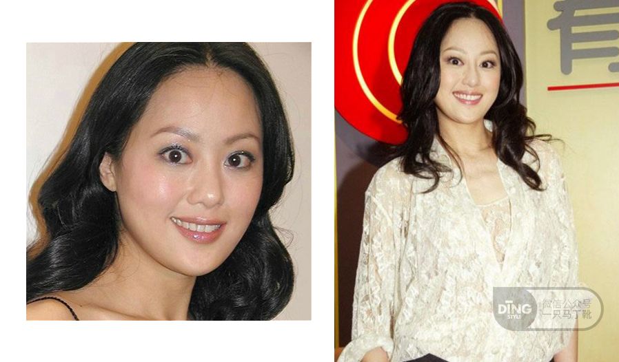 为什么眼神呆滞无神怎么训练,表情僵硬眼睛无神