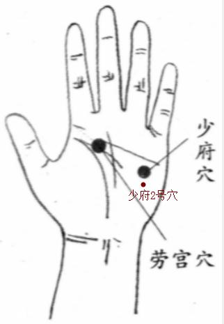 红眼病滴一天眼药水就好了,红眼病治疗一天后状况