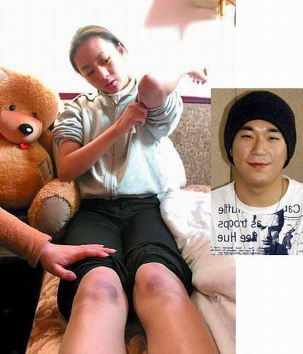 童瑶被张默打怎么处理的,童瑶是张默殴打的人吗