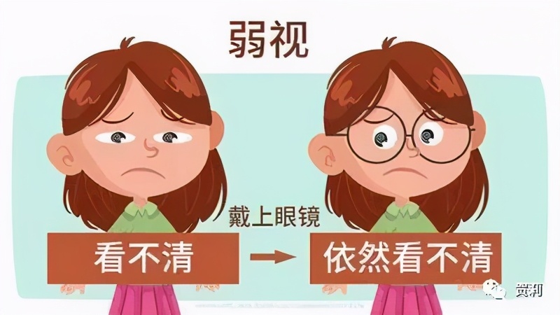 弱视最好的遮盖疗法,弱视为什么要遮盖单眼治疗