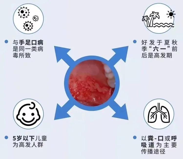 疱疹性咽峡炎是什么原因引起的,疱疹性咽峡炎隔离多久可以上学