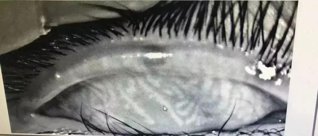 家长急死！11岁男生经常躲被窝里干这事！医生：已无法彻底恢复！